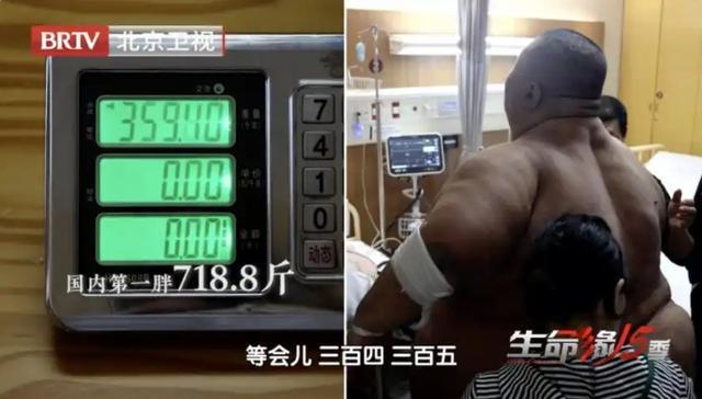 718.8斤男子刷新中国第一胖纪录,55天减重230斤