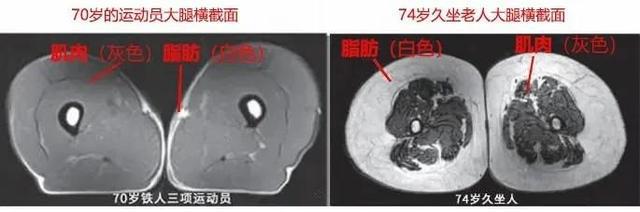 运动是加速衰老，还是延缓衰老？真相揭开