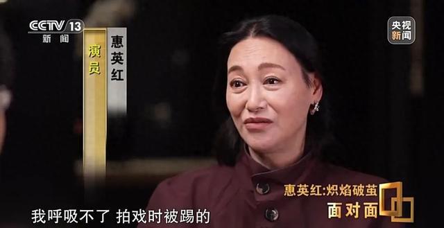 65岁惠英红回应“脸上缝过89针”：鼻子是歪的，眼睛大小不一样，但不工作生命没有意义