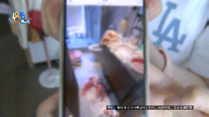 穿搭博主洗完澡后，浴室玻璃炸了！当事人：全身不知道缝了多少针