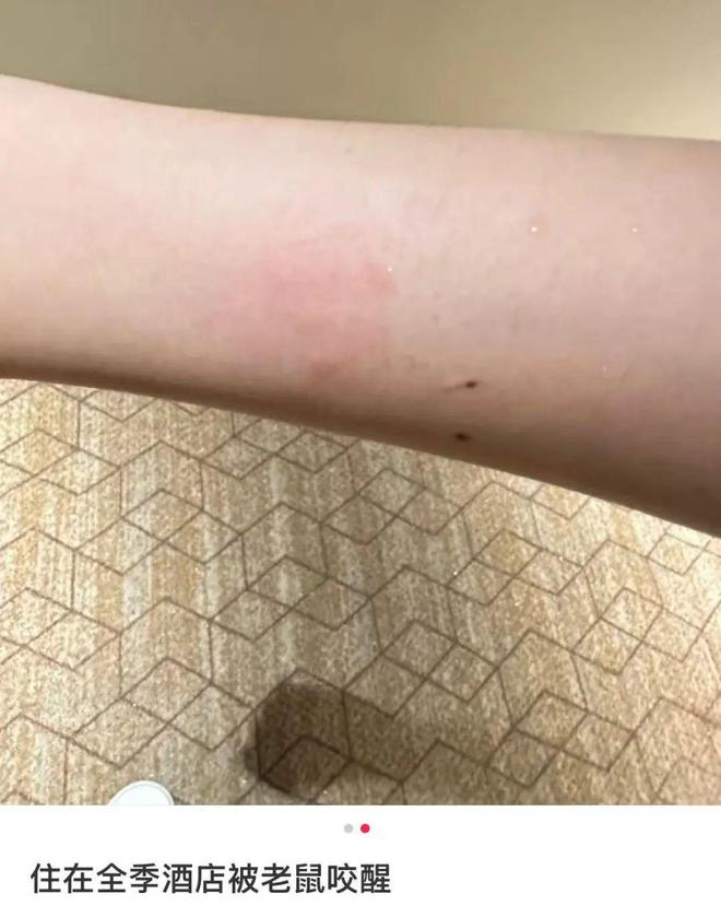 长沙一女子入住南昌全季酒店半夜被老鼠咬醒，投诉人：酒店提出赔偿5000元，“无语”