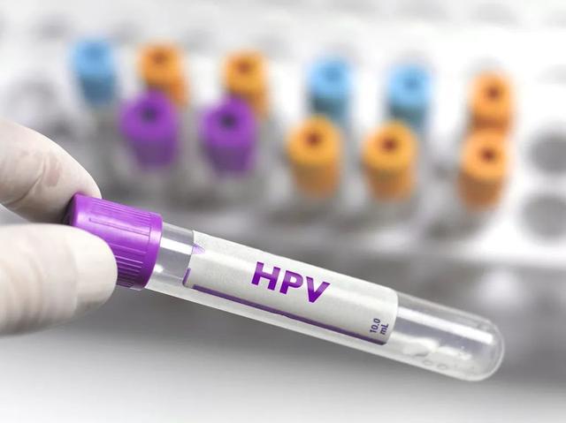 在酒店这样洗澡可能感染HPV病毒？有网友称中过招！公共场所请避免这样做↗