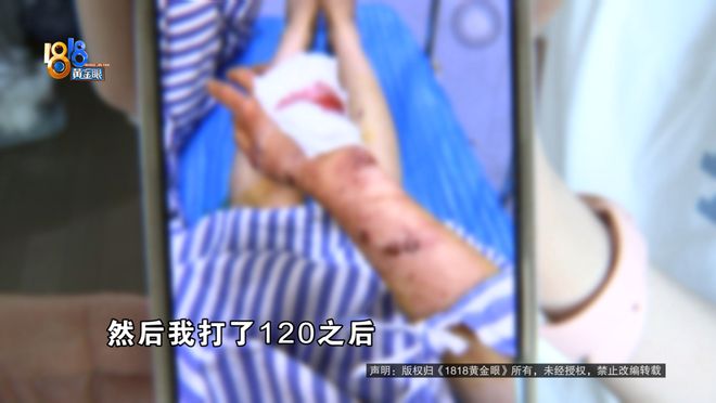穿搭博主洗完澡后，浴室玻璃炸了！当事人：全身不知道缝了多少针