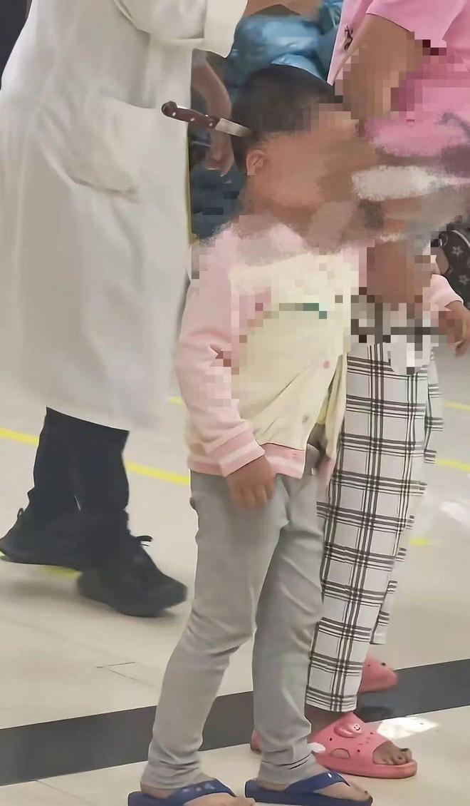 云南3岁女童“头上插刀”淡定走进医院就医，科室工作人员称接受开颅手术后已成功取出，目前情况稳定