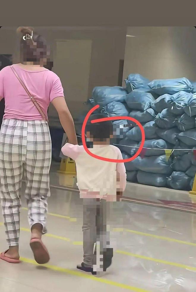 云南3岁女童“头上插刀”淡定走进医院就医，科室工作人员称接受开颅手术后已成功取出，目前情况稳定