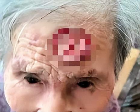 太狠了！98岁阿婆拿起剪刀，对准自己一刀下去……后果很严重！