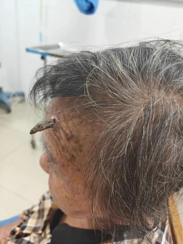 太狠了！98岁阿婆拿起剪刀，对准自己一刀下去……后果很严重！