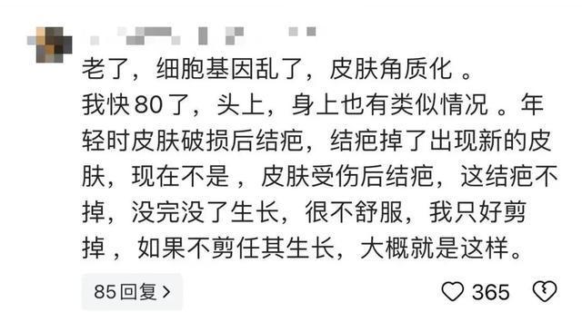 太狠了！98岁阿婆拿起剪刀，对准自己一刀下去……后果很严重！